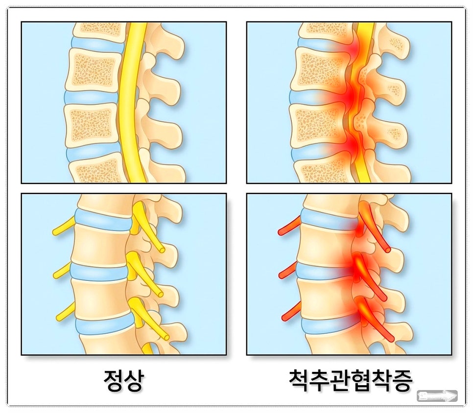 c25ca-6a90e4474af93-dc7e0494fe14ee56a8aea864b2bd9baf6be8903f.jpg